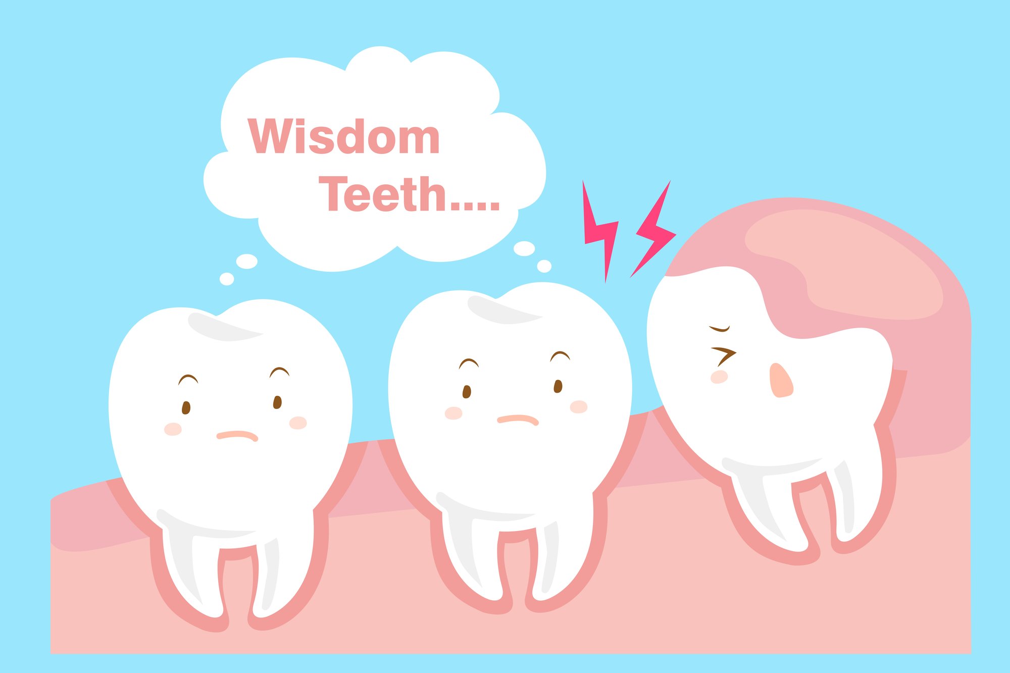 trường hợp cần nhổ răng khôn